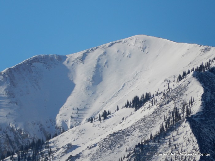NE aspect, Whetstone